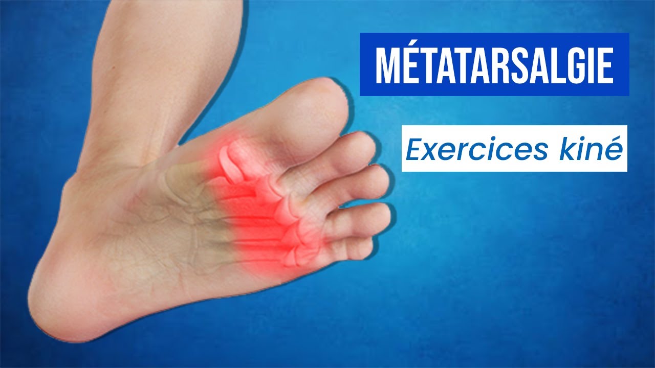 Métatarsalgie : Traitements et Exercices kiné